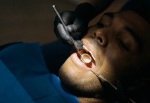 Say Goodbye to Wisdom Tooth Pain: Safe and Effective Extraction Options in Guildford